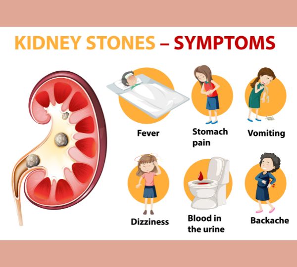 Common symptoms of kidney stones